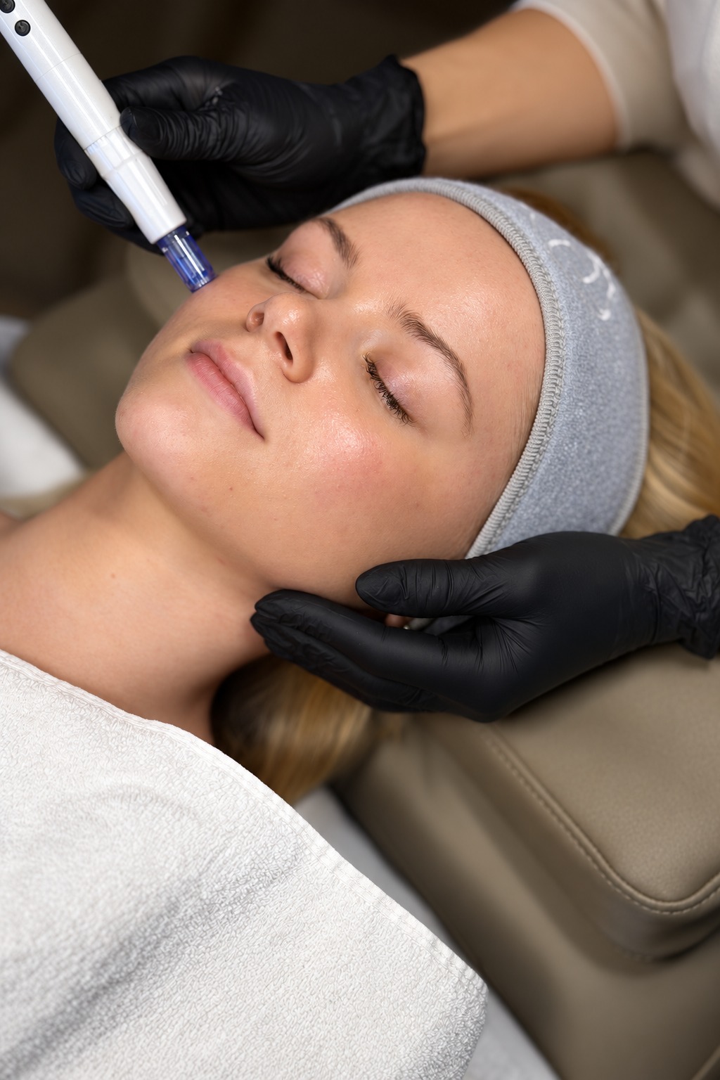 Kunde får microneedling på kinden med en håndholdt pen